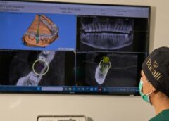 ¿Por qué los implantes dentales NO son para cualquiera?